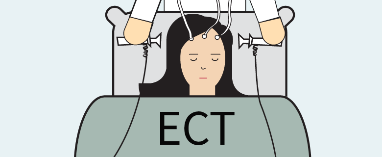 전기경련요법(ECT, electroconvulsive therapy) : 전류가 뇌를 통과하여 뇌의 신경 전달 물질의 기능과 효과에 영향을 주어 우울증을 완화시 