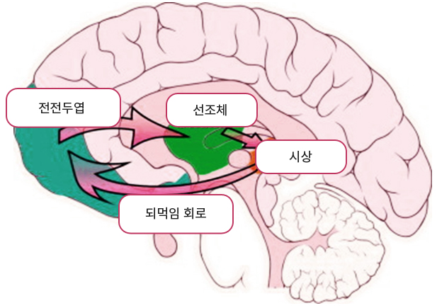 뇌 피질-선조체-시상 회로의 구조 및 기능 변화: 뇌영상 연구들에서 강박장애 환자들은 피질-선조체-시상 회로와 관련된 시상(thalamus),  